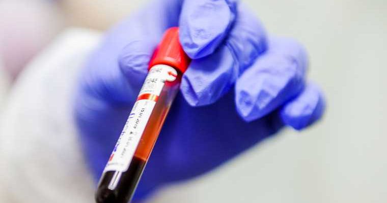 Челябинская область карантин отмена запрет разрешения Текслер