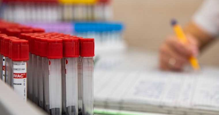 Алан спенсер американец в перми миозит лимфатек