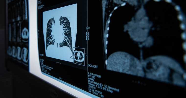 поражение легких