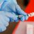 Гинцбург раскрыл эффективность «лайт-вакцины» от коронавируса