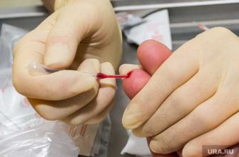 пермяки сдавшие тест на опасное заболевание получат сувениры